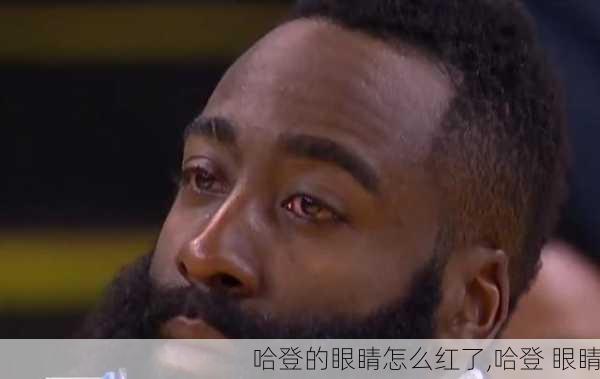 哈登的眼睛怎么红了,哈登 眼睛